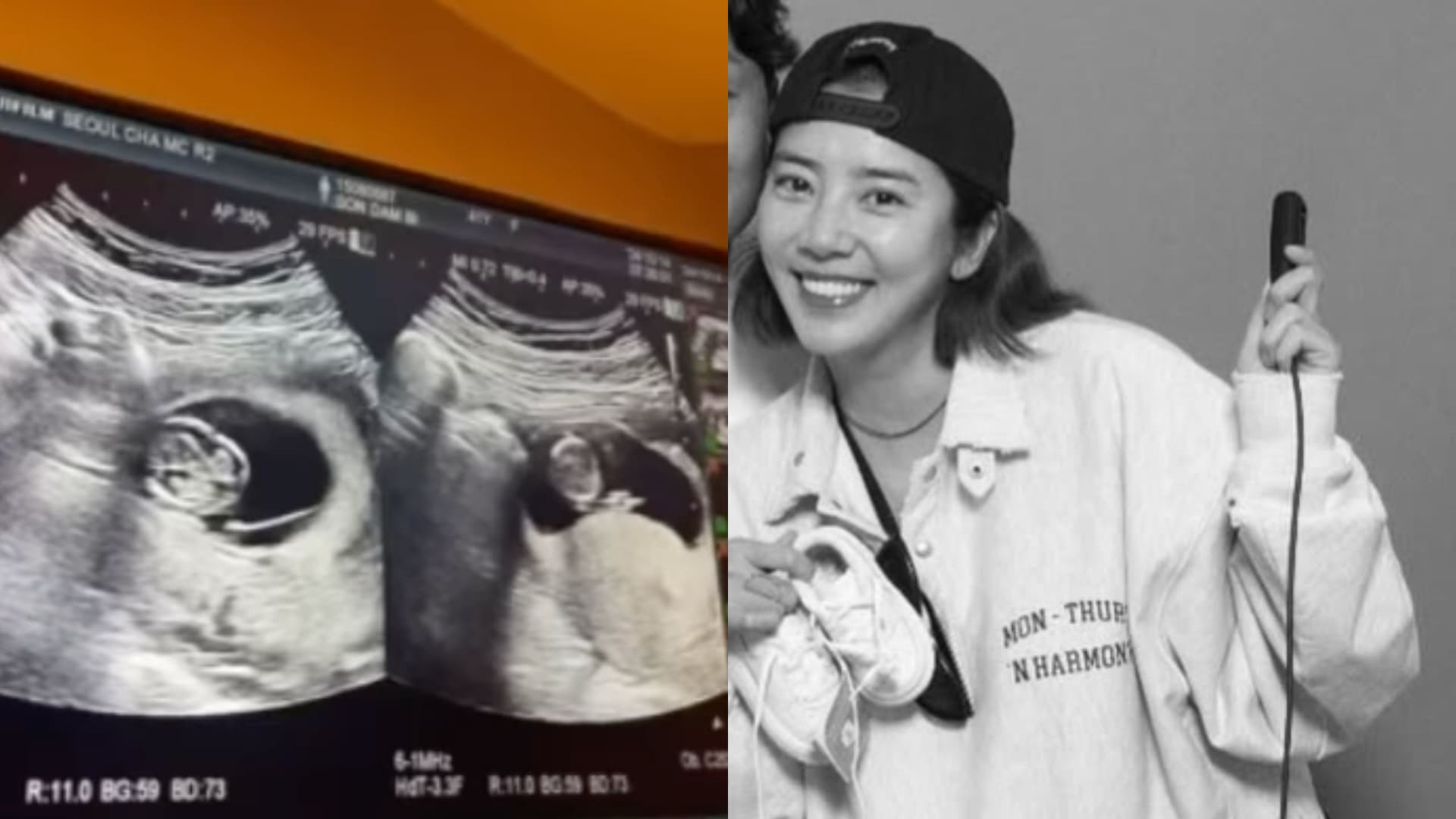 剩3個月準備卸貨！41歲高齡產婦孫淡妃突曝檢查結果：很受挫！