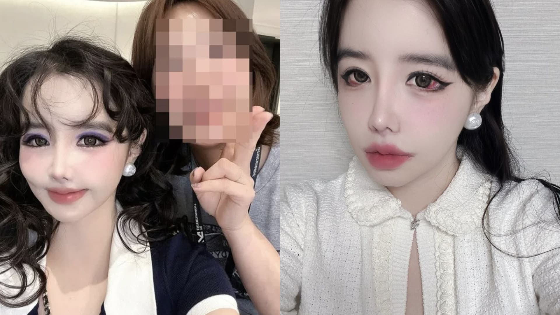 整張臉越變越扭曲？朴春疑似「整形上癮」粉絲崩潰苦求：不要再整了！