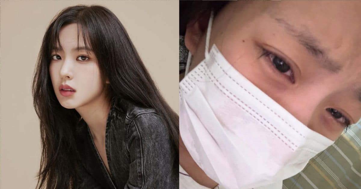 女團視覺成員患血癌！治療3個月「剃髮+長胖」照曝光