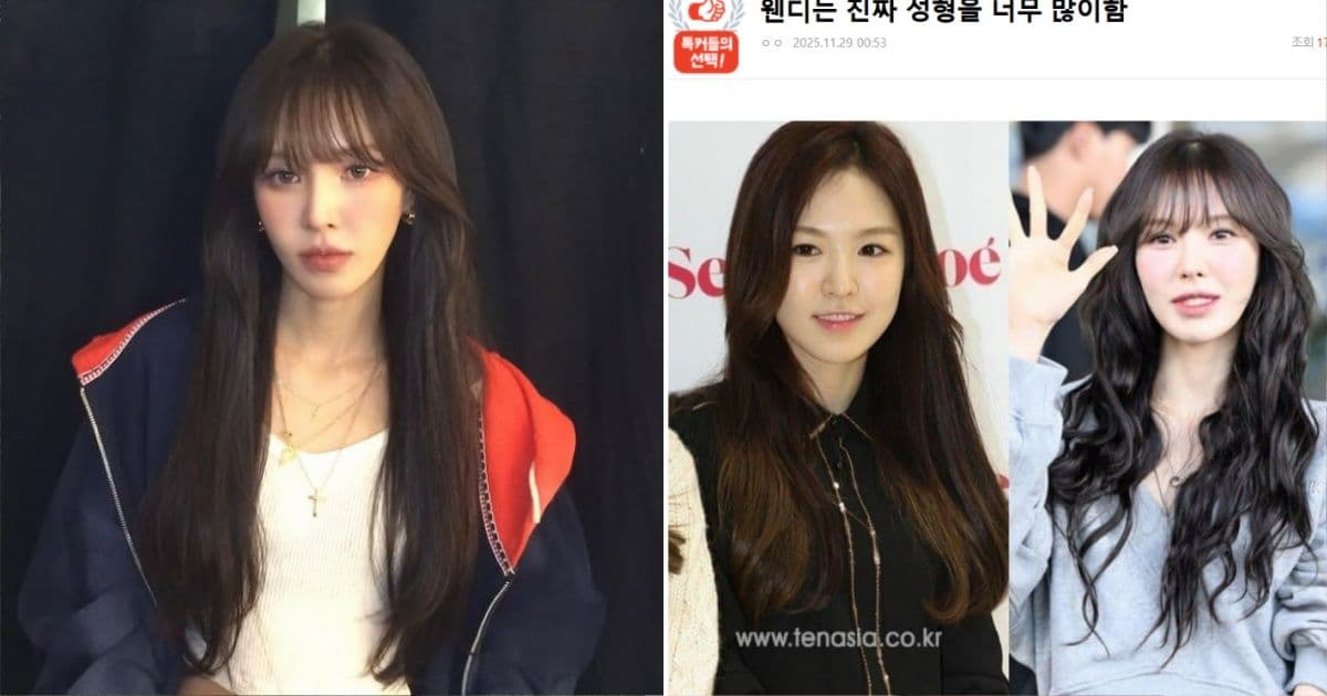 酸Wendy「整太多」慘被圍剿！19萬人嗆爆原PO 力挺：又美又努力關你什麼事