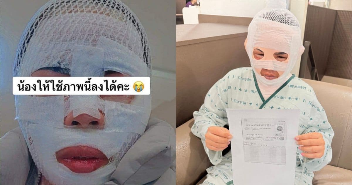 泰女被韓男友「趁睡潑熱水」臉部重傷！驚悚真相曝光：怕她跟別人走