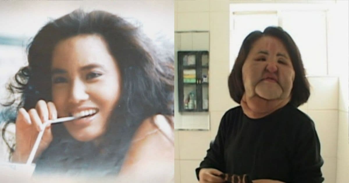 沙拉油注射全臉！「電風扇阿姨」整形前美照曝光 非法整形背後原因首曝光