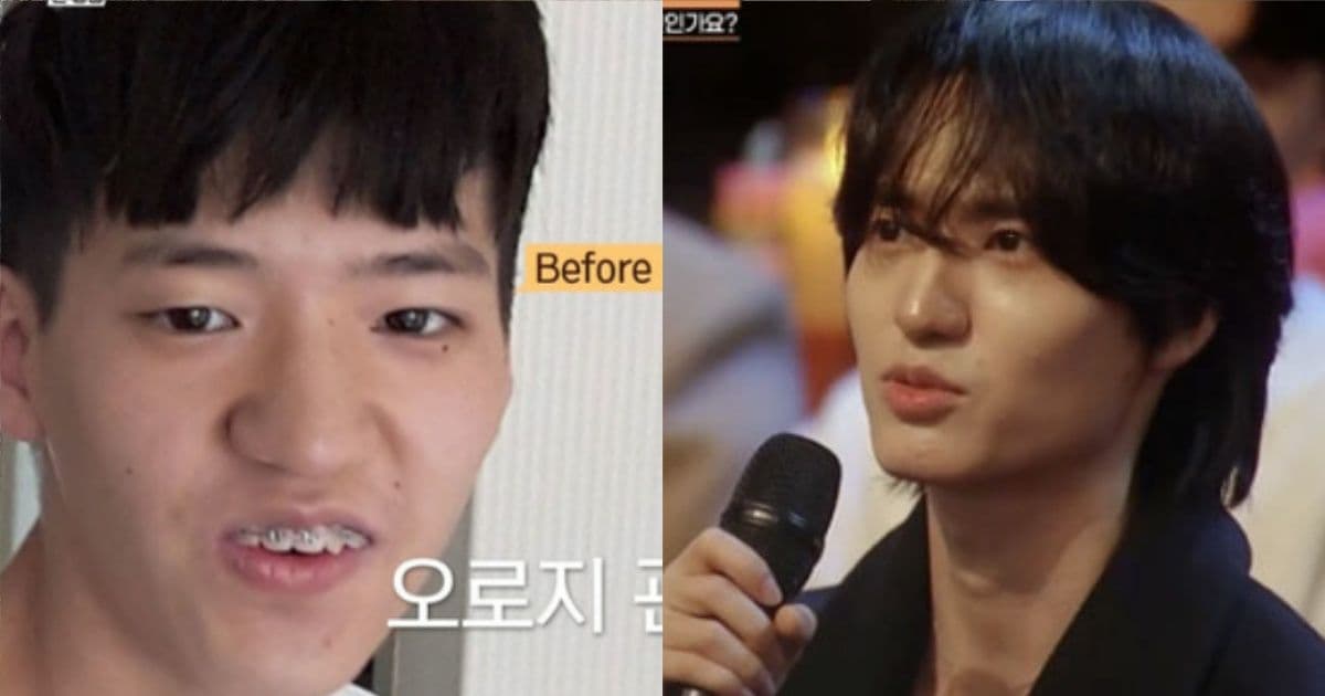 零醫美逆天變臉！韓男只靠保養帥成偶像級 姐姐卻快氣瘋「背後原因曝光」