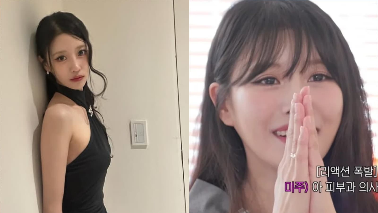 被分手1年半後首相親！Lovelyz李美珠狂撩皮膚科醫師　直球示愛還交換電話