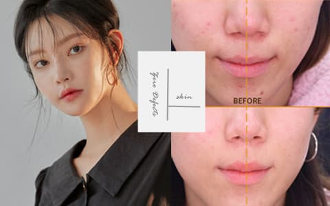 韓國小編親測!黑肉底,雀斑,瑕疵女孩也能擁有無暇白皙肌?韓國超夯的4款美白精華測評